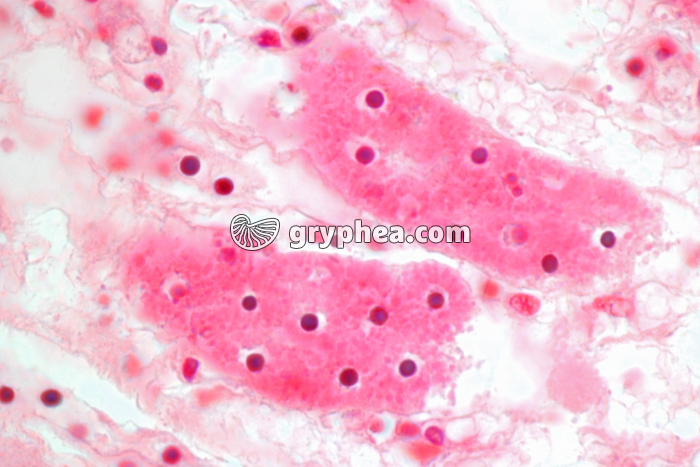 Rejet Greffe de rein x 600 - gryphea.org